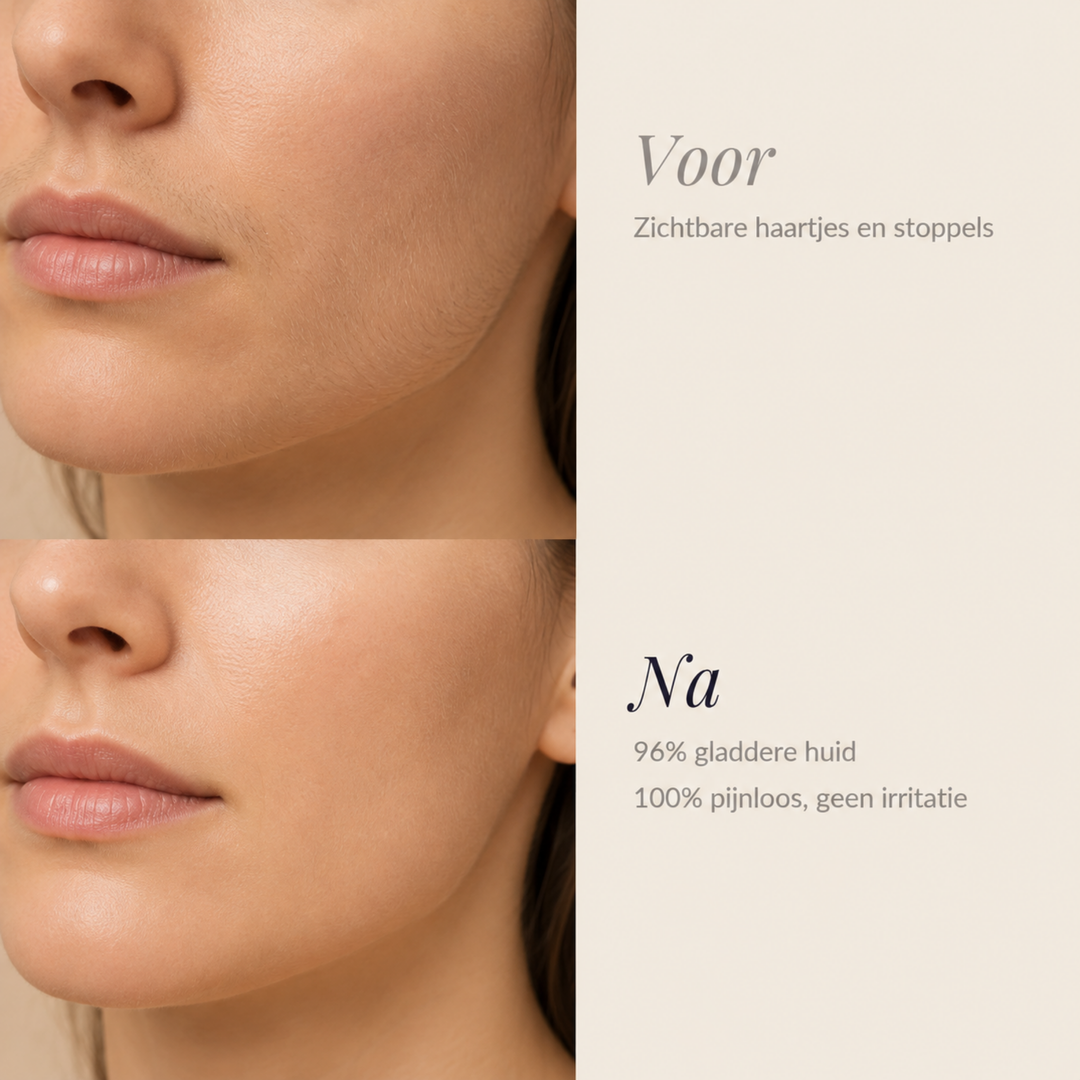 Sonic facial hair remover for women – smooth skin in 5 minutes