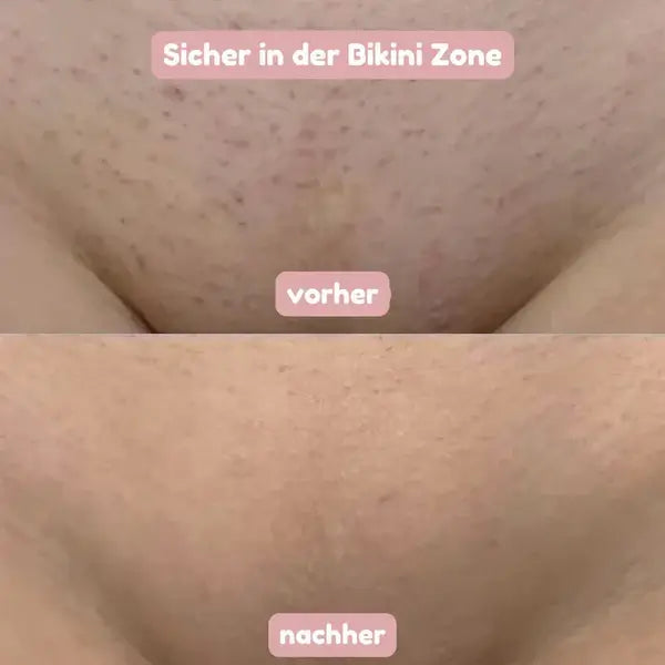2-in-1 Women's Razor for Smooth, Gently Cared-for Skin