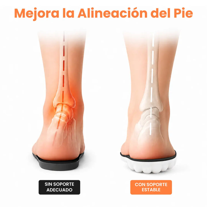 Orthopaedic Insoles for Heel Spurs and Plantar Fasciitis