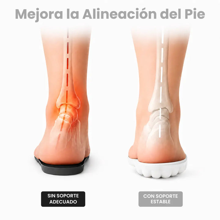 Orthopaedic Insoles for Heel Spurs and Plantar Fasciitis