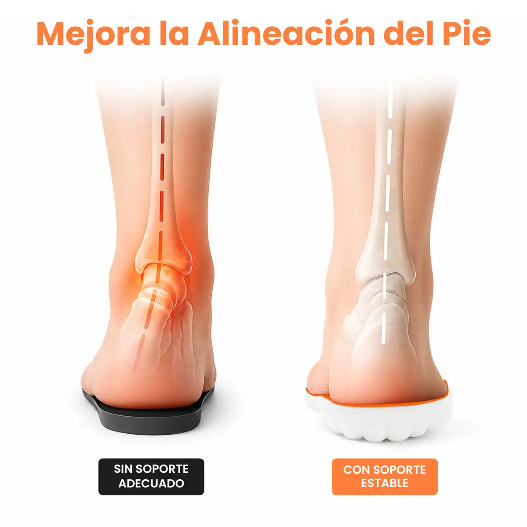 Orthopaedic Insoles for Heel Spurs and Plantar Fasciitis