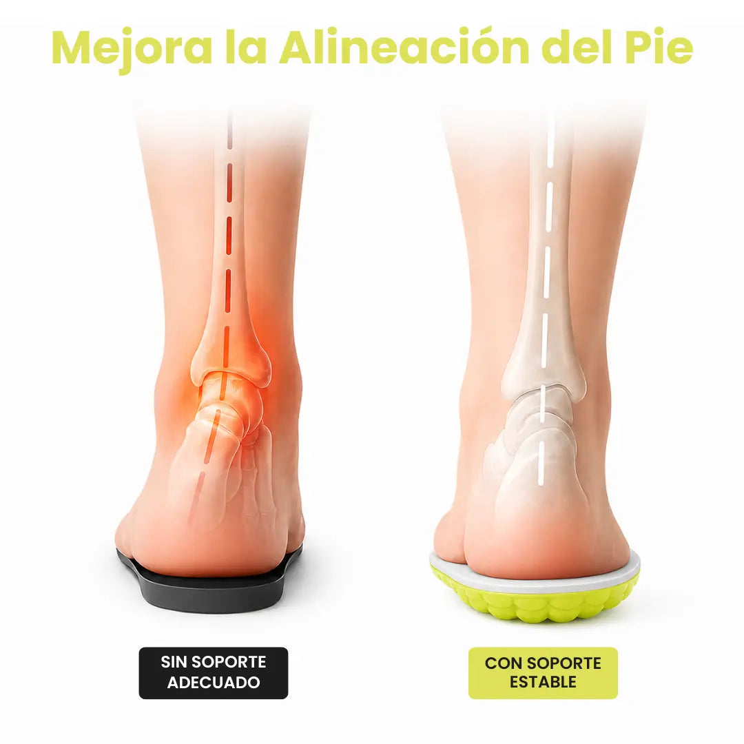 Orthopaedic Insoles for Heel Spurs and Plantar Fasciitis