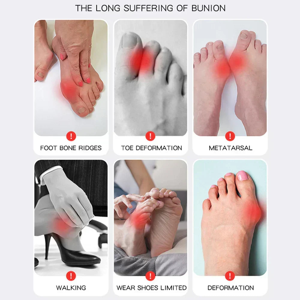 1+1 FREE | Hallux Valgus™ | Your Comfortable Solution for Pain-Free Feet!