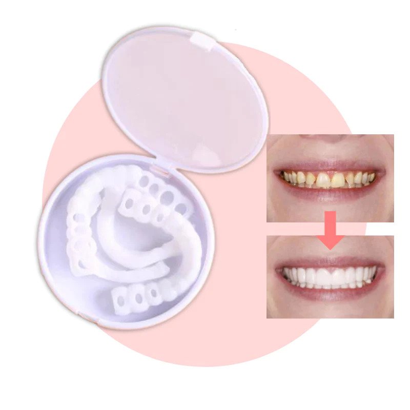Snap-On Veneers | Flexible, Glue-Free Fit for Meals and Daily Use