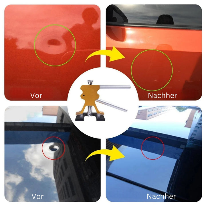 Dent Removal Tool | Remove Dents and Dings from Your Car | DellenMeister