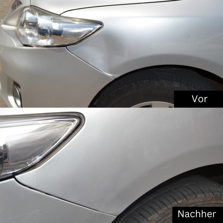 Dent Removal Tool | Remove Dents and Dings from Your Car | DellenMeister