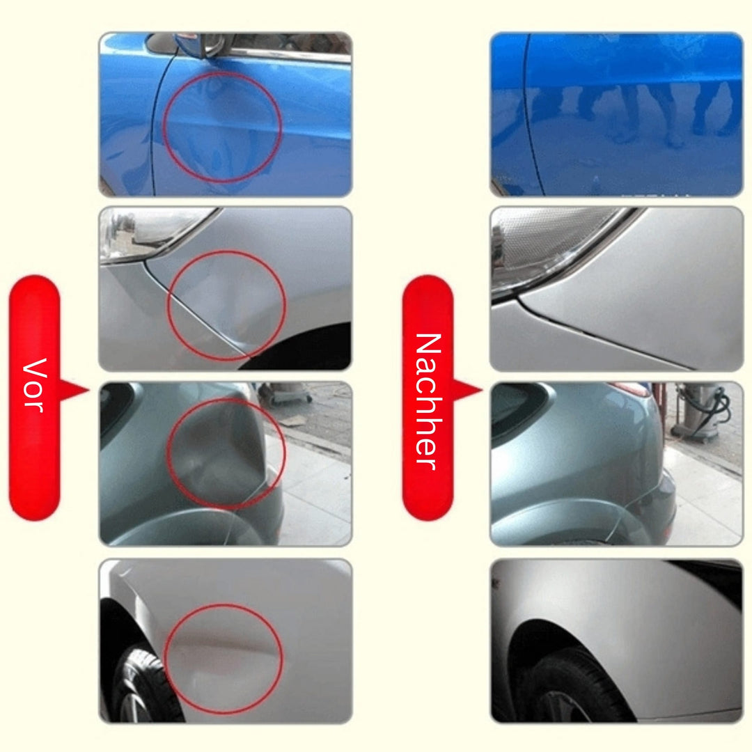 Dent Removal Tool | Remove Dents and Dings from Your Car | DellenMeister