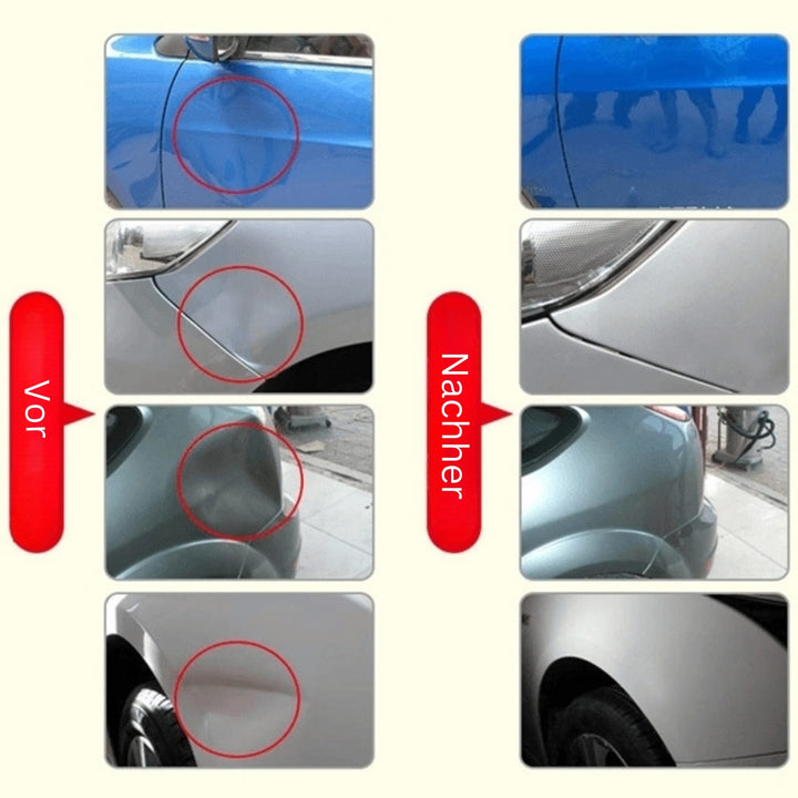 Dent Removal Tool | Remove Dents and Dings from Your Car | DellenMeister