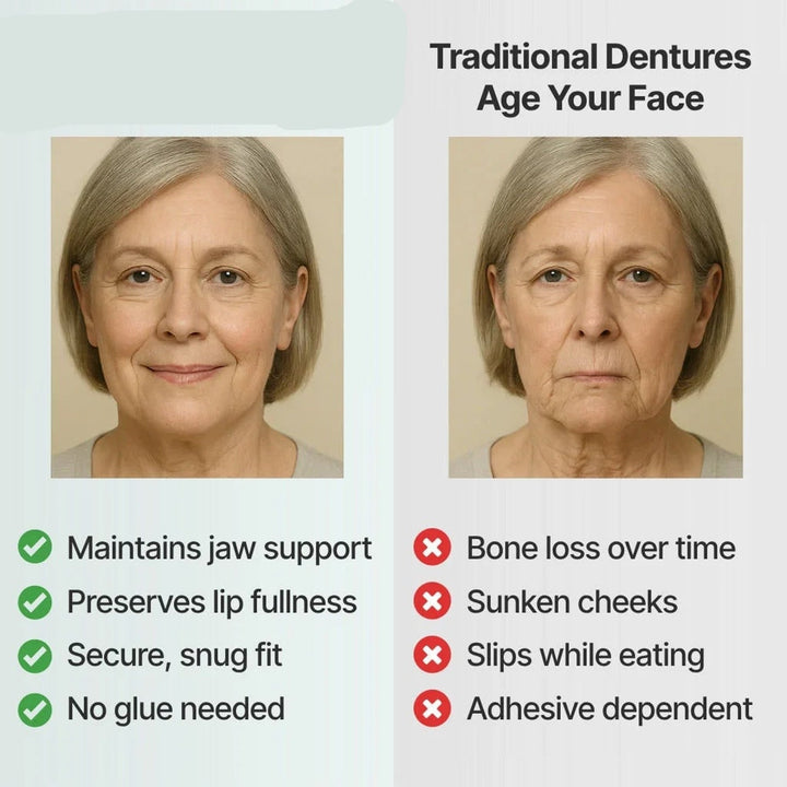 Removable full-arch denture set with flexible cushioned grip for daily use