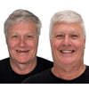 Removable Full-Arch Denture Set with Flexible Cushion Grip for Daily Use