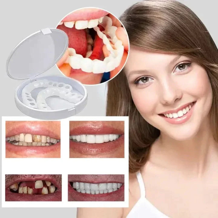 Snap-On Dental Veneers | Adjustable