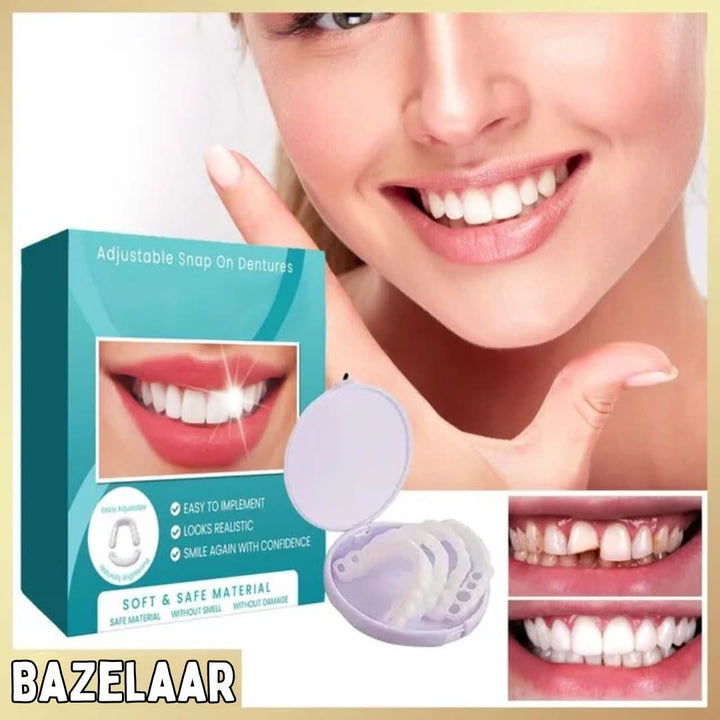 Snap-On Dental Veneers | Adjustable